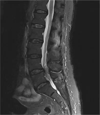 Lumbar spine imaging used to support back and neck pain treatment planning